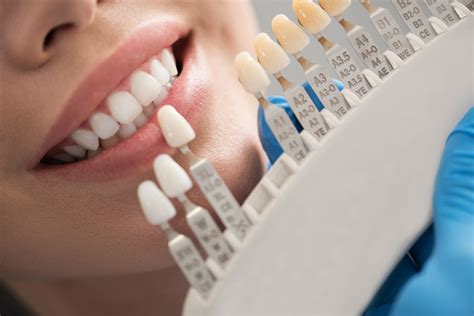 Front Tooth Crown Procedure