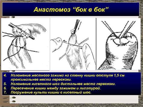 ЛАПАРОТОМИИ Виды лапаротомий Продольные Косые Переменные Поперечные