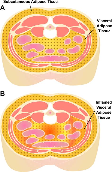 Visceral (VAT) and subcutaneous (SAT) adipose tissue depots. (A ...