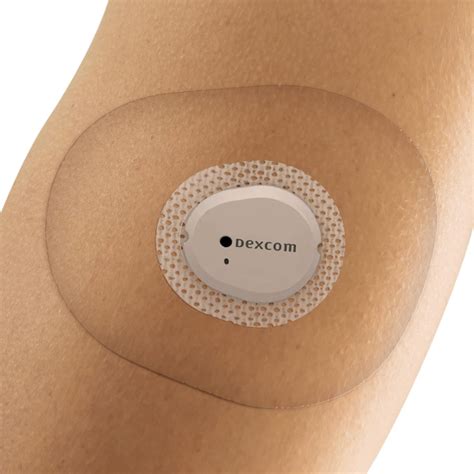 maximizing  dexcom  sensor life tips  tricks
