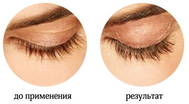 КУПИТЬ КАРЕПРОСТ (Сareprost), Latisse цена, careprost купить, средство ...
