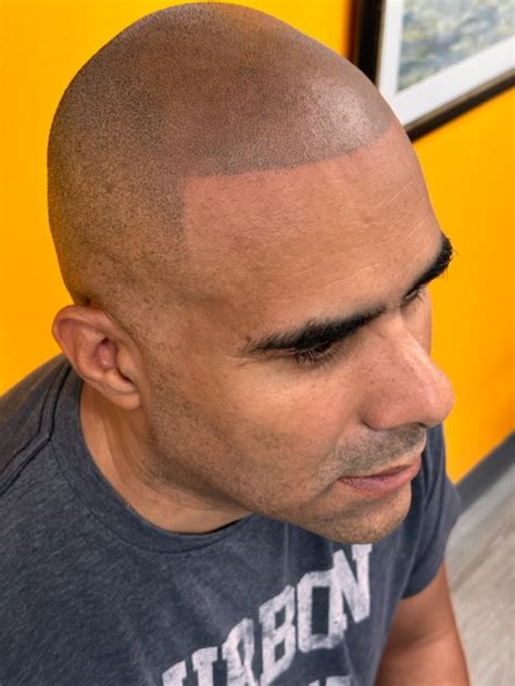 silver spring md scalp scar camouflage smp virtuosos