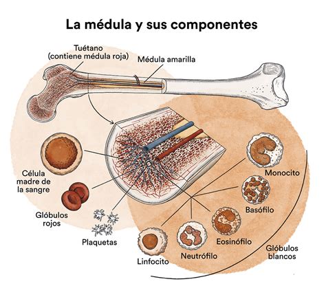 Aplasia De Medula - Anemia Aplásica Médula ósea