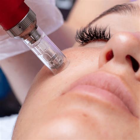 tattoo numbing cream emla 11