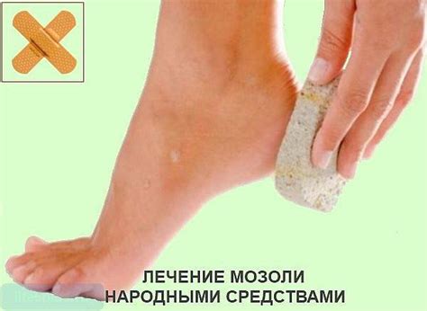 Как избавиться от мозолей на ногах в домашних условиях
