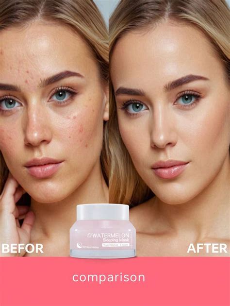 Watermelon Face Moisturizer - Face Moisturizer For Oily Skin | Light ...