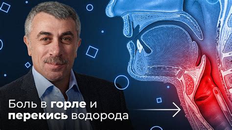 ШДК: Боль в горле. Перекись водорода - Доктор Комаровский - YouTube