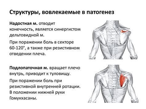 Плечелопаточный периартрит - презентация онлайн
