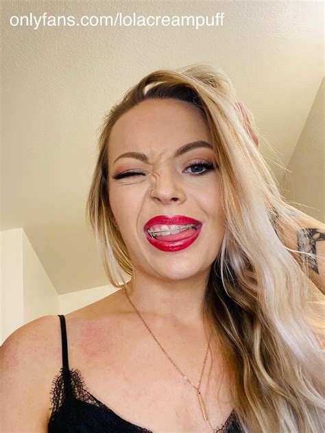 Best way to dress up your braces? BRIGHT RED LIPSTICK 😘 | Scrolller