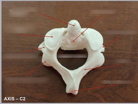 axis 2 Diagram | Quizlet