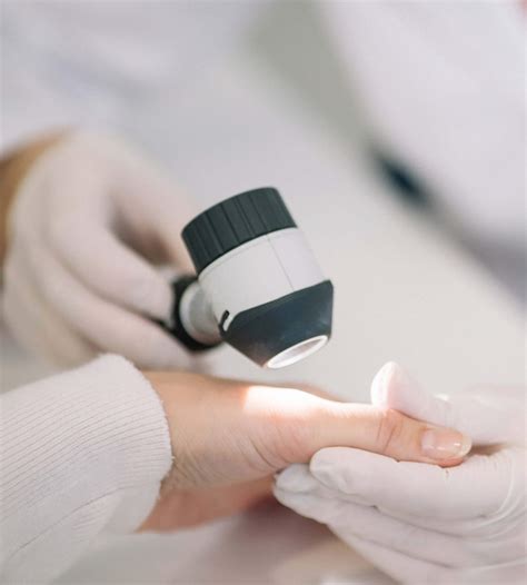 Benign Skin Tumours - Dermatologist Singapore | Skin Specialist Clinic