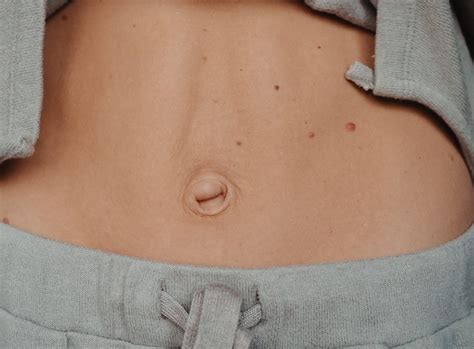 Umbilical Hernia & Belly Button Bulge Singapore | Ark Surgical