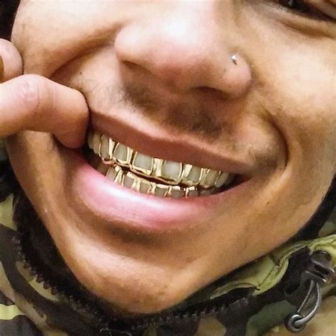 Open Face Gold Teeth Designs - Design Talk