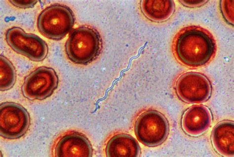 Borrelia Burgdorferi Lm Photograph by Michael Abbey | Pixels