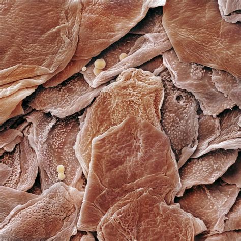 dead skin cells     microscope  nathan dwyer blog
