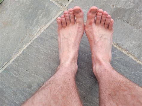 Left ankle pain - noticed the muscle is smaller on one foot than the