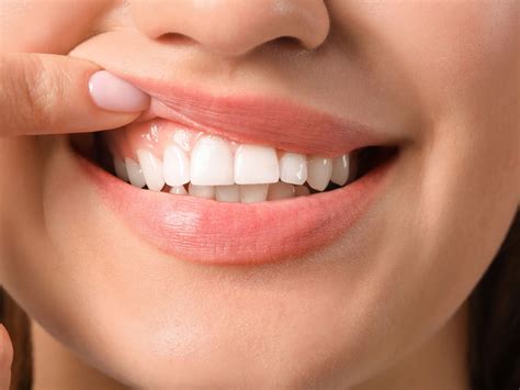 Tooth Gum - Abay Dental