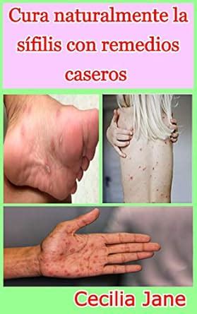 Remedios Caseiros Para Sifilis - Cura naturalmente la sífilis con remedios caseros eBook : Jane, Cecilia ...