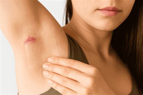 Hydrocolloid Bandages for Hidradenitis Suppurativa – Fresinider
