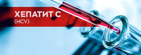 Хепатит C - CheckPoint Sofia