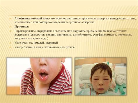 Анафилактический шок - online presentation