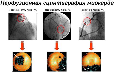Кардиосклероз: что это такое, как его как лечить, симптомы