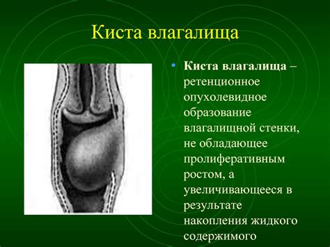 Опухоли женских половых органов - презентация онлайн