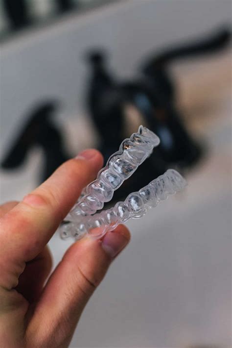 Retainer Replacement: Cost and How to Get a New Retainer - Dentaly.org