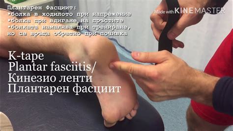 Кинезио ленти за плантарен фасциит - YouTube
