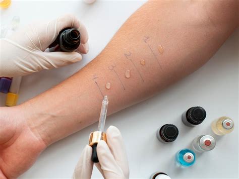 allergy testing  immunotherapy mullica hill medical nj