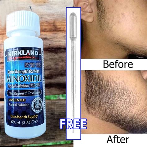 Minoxidil scam or legit – ingredients list – review – price – compares ...