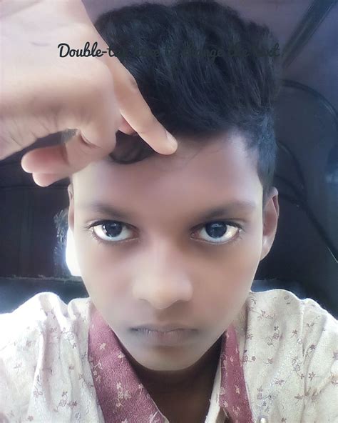 White Hair Streak Syndrome