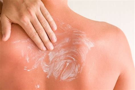 Symptoms and Causes of Polymorphic Light Eruption - Facty Health