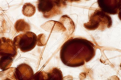 Mould (Mucor mucedo), light micrograph - Stock Image - C038/5317 ...