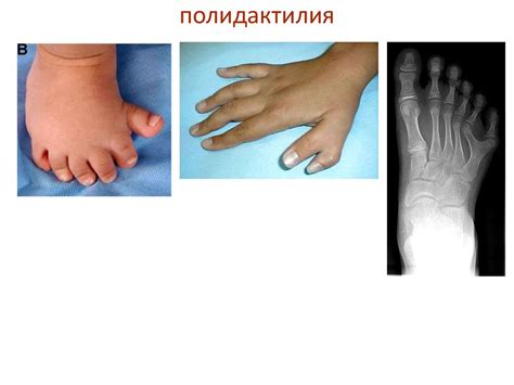 Особенности изучения наследственности человека - презентация онлайн
