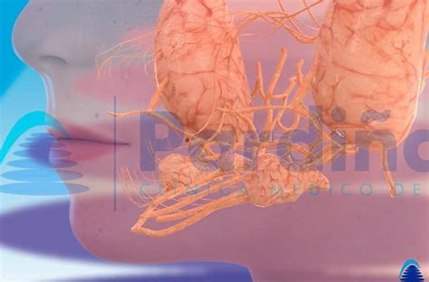 Cálculo Na Glândula Salivar - Sialolitiasis – Causa y tratamiento del cálculo en la glándula salival ...