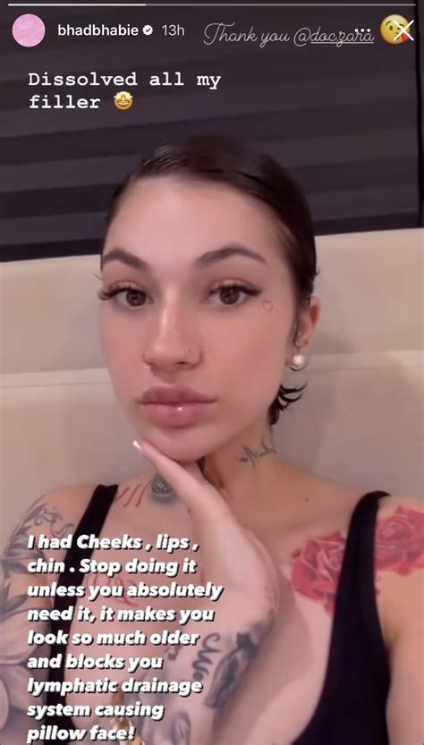 Bhad Bhabie Removed Her Filler