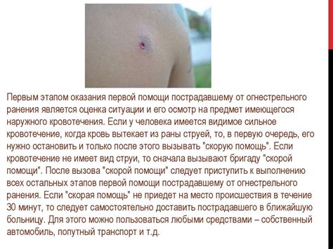 Огнестрельные ранения. Первая помощь - презентация онлайн