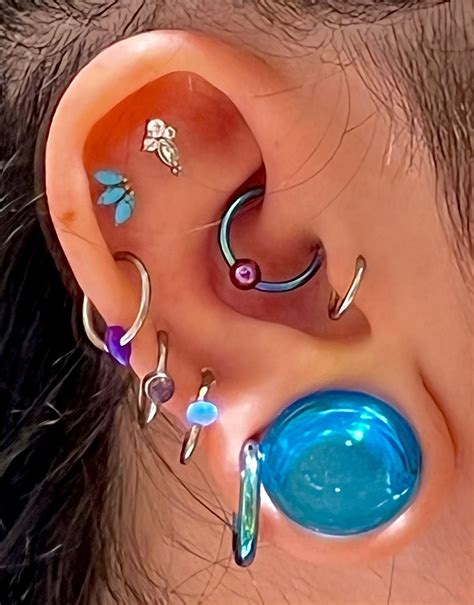 Should I be concerned about my ear swelling almost exactly a week after