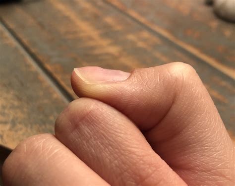 What causes extreme nail wavy-ness? : r/Nails