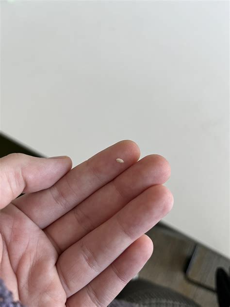 got wisdom teeth out a few months ago, and there’s been a shard of bone