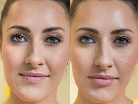 Elissa Before And After