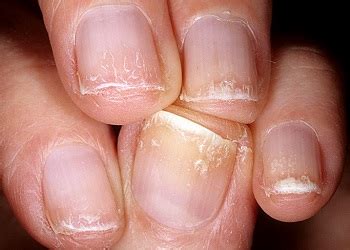 Ванночки для ногтей в домашних условиях: эффективные рецепты от ...