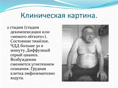 Астматический статус - презентация онлайн