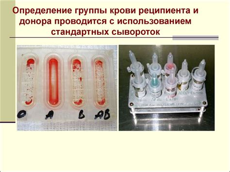 Переливание крови и кровезаменителей - презентация онлайн