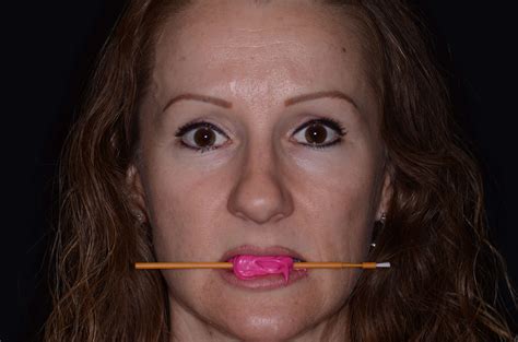 Taking a Stick Bite - Restorative Nation