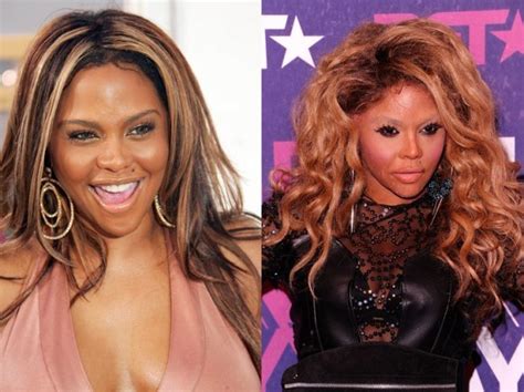 Plastic Surgery: Botched or Better?