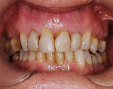 Best Dental Clinic and Dentist in Bali - Kalm Dental Care
