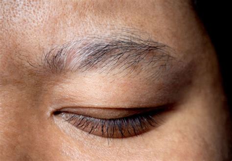 Empowering Beauty: Microblading Eyebrows for Alopecia and Patchy Eyebrows