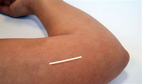 Implant Contraceptive